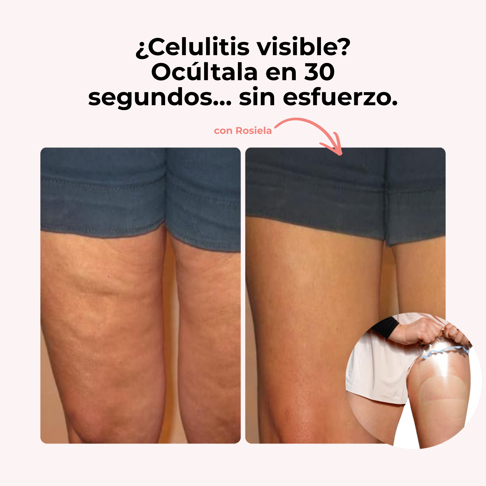 Parches Tensor Invisibles Efecto Lift & Glow